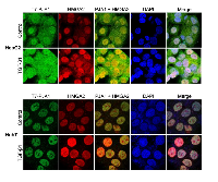 Figure 5:  Confocal microscopic analysis showed that PJA1 colocalize with HMGA2 in the nuclei of HepG2 and Huh7  cells and TGF-β treatment enhances the colocalization. 