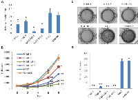 Figure 3:  Suppressive effect of transfection of Id1- and Id3-shRNAs jointly or Id1-shRNA alone on invasiveness and  proliferation of N417 cells. 