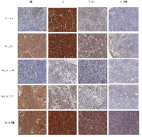 Figure 5:  Immunohistochemistry analysis of the expression status of Id1, Id3, VEGF, and the microvessel densities  (by  CD34  antibody)  of  tumors  produced  in  mice. 