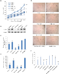 Figure 6:  Effect of suppressing Id1 and Id3 or Id1 alone on cell apoptosis and angiogenesis. 