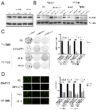 Figure 1: KDM3A is expressed in FN-RMS and FP-RMS patient-derived cell lines, and promotes colony formation  and transendothelial invasion. 