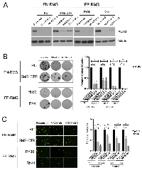 Figure 4:  MCAM promotes colony growth and transendothelial invasion in FN-RMS and FP-RMS cells. 