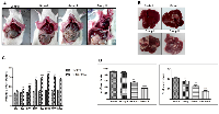 Figure 1: DEN+CCl4 induced hepatocarcinogenesis was associated with visceral adiposity. 