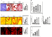 Figure 2:  DEN+CCl4 induced hepatocarcinogenesis was associated with increased lipidosis and fibrosis in hepatocytes. 