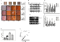 Figure  4:  Enhanced  E2F1  is  associated  with  increased  expression  of  adiponectin  in  DEN+CCl4  model  of  hepatocarcinogenesis. 