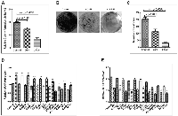 Figure 8:  Pharmacological inhibition of SHH signaling pathway is associated with decreased tumorigenicity of Hep3B  cell-line in soft-agarose assay. 