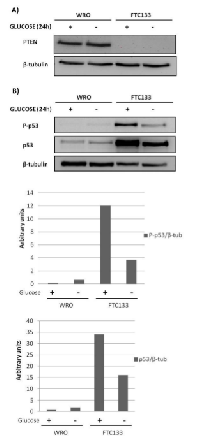 Figure 1: The effect of glucose availability on the  expression of PTEN and p53 in WRO and in FTC133  cells. 