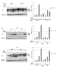 Figure 4:  Induction of autophagy in WRO and FTC133 cells by glucose depletion. 