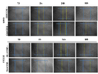 Figure 5:  Glucose depletion differentially affect cell  migration of WRO and FTC133 cells. 
