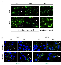 Figure 6:  Differential uptake of glucose and plasmamembrane expression of GLUT1 in WRO and FTC133 cells. 