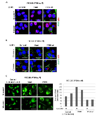 Figure 8:  Effect of ectopic expression of PTEN in FTC133 cells on the cellular expression of GLUT1 and LC3 and on  glucose uptake. 