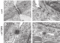 Figure 3:  Electron microscopy of HT29 cells. 