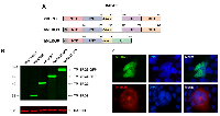 Figure 1: TMPRSS2-ERG