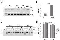 Fig. 3:  AATK expression in cancer cells, reexpression and demethylation under Aza treatment.