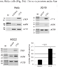 Fig. 4:  CTCF induced reexpression of AATK.