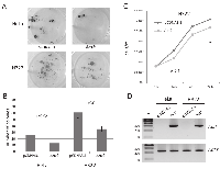 Fig. 6:  Overexpression of Aatk reduces colony formation and proliferation of cancer cell lines.
