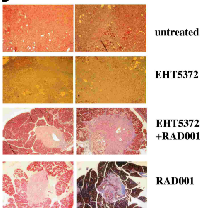 Fig.6:  Pancreatic tumors in mice treated with Mirk/ dyrk1B inhibitor EHT5372 have more collagen-  containing stroma than tumors from mice left  untreated  until  sacrifice  at  8  weeks. 