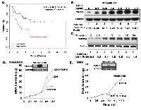 Fig. 1: Prognostic significance of TMEPAI expression in metastatic breast cancer patients and its TGF-β dependent  induction in breast cancer cells. 