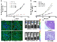 Fig. 9:  Role of TMEPAI-PTEN axis in growth and metastatic behavior of breast cancer cells.