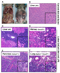 Figure  1: Alcohol-  and  LPS-treated  mice  develop  aggressive lymphoma. 