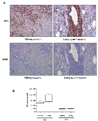 Figure  2:  Alcohol-  and  LPS-induced  lymphoma  in  TGF-β  signaling  pathway  mutant  mice  is  T-cell  lymphoma. 