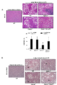 Figure  4:  Alcohol-  and  LPS-treated  mice  develop  liver  steatosis  but  not  significant  liver  fibrosis. 