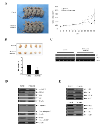 Figure 6:  Doxazosin suppresses tumor progression in nude mice. 