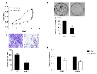 Figure 1: Tumor suppressive effects of miR-31 in TE-7 ESCC cells. 