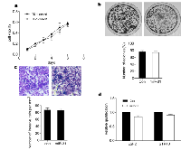 Figure 2:  Lack of miR-31-mediated suppression in TE-1 ESCC cells. 