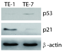 Figure 3:  p21 was highly expressed in TE-1 cells  and cannot be detected in TE-7 cells. 