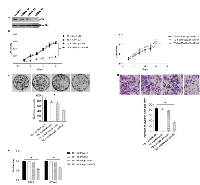 Figure 4:  Inhibitory effects of miR-31 can be rescued in TE-1 cells by p21 shRNA treatment. 
