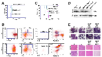 Figure 3:  The secondary transplantation of AAFP-induced leukemia and the leukemia maintaining subpopulation. 