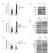Figure 5:  Effects of DUSP10 knockdown and nonphosphorylatable or phosphomimetic mutant overexpression on  GBM responses to mTOR kinase inhibition. 