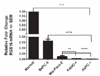 Figure  4:  Decreased  expression  of  RGS16  mRNA  relative  to  total  RNA  extracted  from  normal  human  pancreatic tissue. 