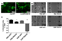 Figure 5:  Expression of RGS16 inhibited migration of BxPC-3 cells. 