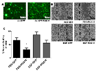 Figure  7:  Expression  of  RGS16  inhibited  migration  of AsPC-1  cells. 