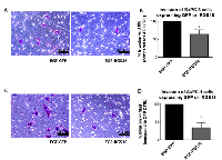 Figure 8:  Expression of RGS16 inhibited invasion of BxPC-3 and AsPC-1 cells. 