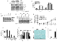 Figure 1: DEPTOR knockdown induces Apoptosis, G1/S cell cycle arrest & senescence in MM cells. 