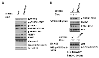 Figure 2:  Molecular effects of DEPTOR knockdown in 8226 cells. 