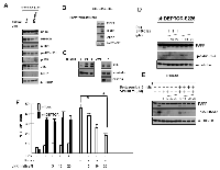 Figure 4:  DEPTOR knockdown-induced Apoptosis is not due to heightened ER stress. 