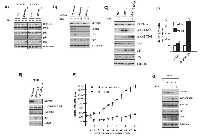 Figure 5:  DEPTOR knockdown-induces  P21 and P27 in a P53-independent fashion. 