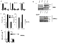 Figure 7:  Role of miRNAs. 