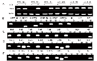 Figure 1: CHFR expression and methylation in esophageal cancer. 