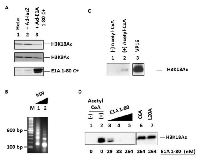 Figure 1: Inhibition of H3K18 acetylation by E1A 1-80 in vivo and in vitro.  