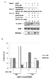 Figure 4:  Increased p300 autoacetylation results in  decreased H3K18 acetylation. 