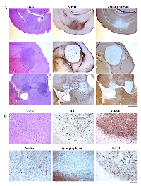Figure 4:  Histological examination of brain sections from RCASBP(A) BRAF-KD and CRE injected mice. 
