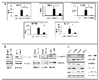 Fig 1: Targeting IKKβ reduces NF-κB activity in KRAS positive lung cells. 