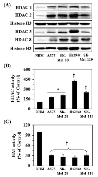Figure 2:  Basal levels of class I HDAC proteins, HDAC  and HAT activity in different melanoma cell lines  compared to normal human melanocytes (NHM). 