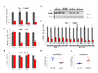 Figure 1: BUB1B knockdown inhibits anchorage-independent growth of lung adenocarcinoma cell lines. 