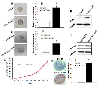 Figure  3:  Cisplatin-resistant  cells  show  increased  stemness  properties  and  metastasis. 